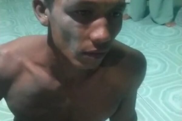 Rizky Aditya Korban Penganiayaan Desak Satreskrim Polres Batubara Tangkap Kedua Pelaku.